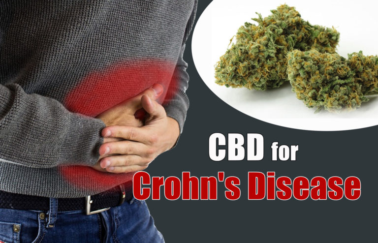 CBD For Crohn's Disease